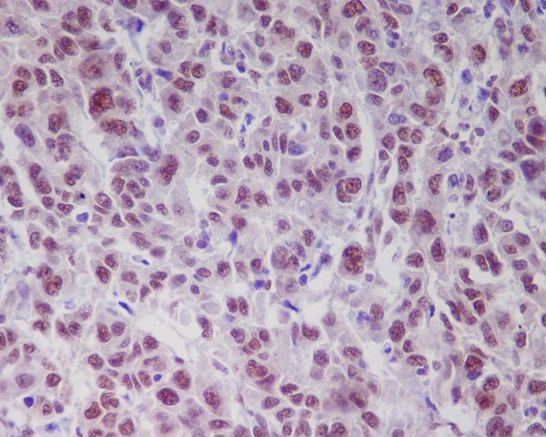 IHC - Anti-Phospho-ATM (S1981) Rabbit Monoclonal Antibody ABO13125